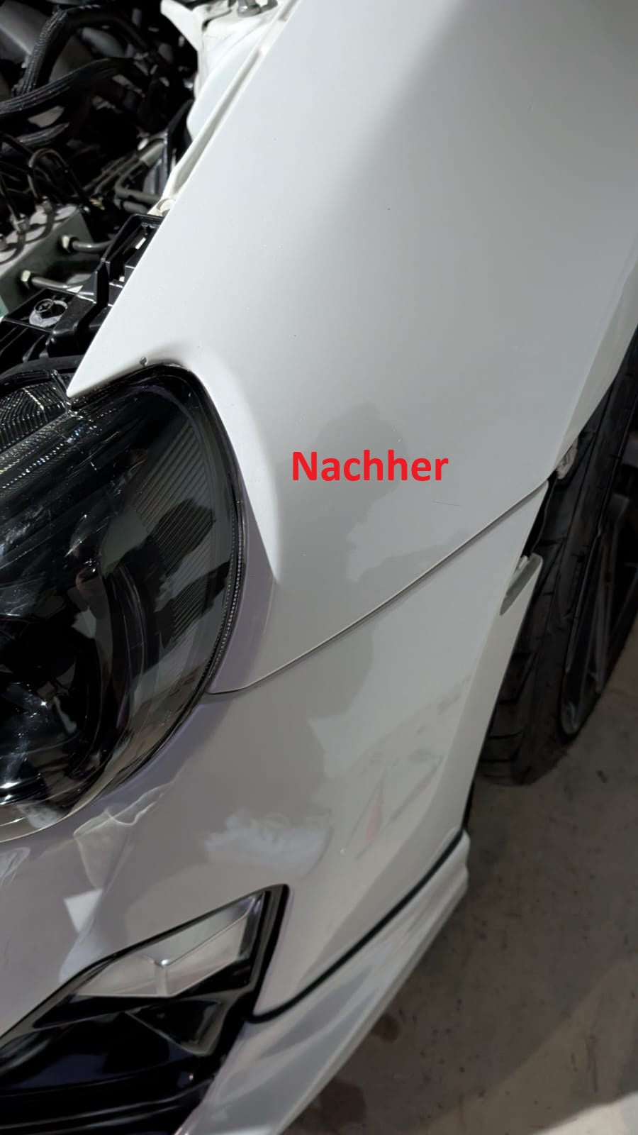 GreenFuchs | Reparatursatz Spaltmaß Frontschürze | Gap Reducer | GT86 & BRZ I
